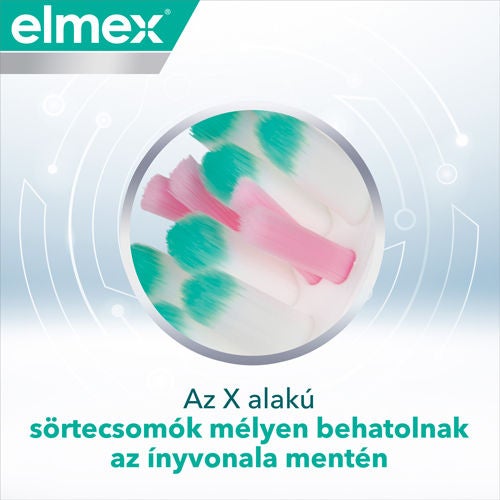 Az X alakú sörtecsomók mélyen behatolnak az ínyvonal mentén