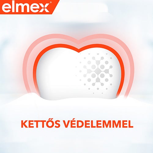 Kettos