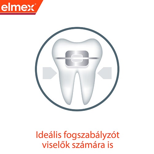 Ideális fogszabályzót